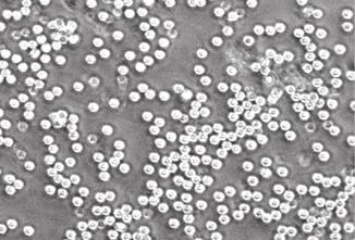 Immunkomplex-felszínen az FcR kritikus szerepl nek bizonyult a sejtek szétterüléséhez is: hiányában a vad típussal A Szuperoxid-termelés (nmol/10 6 sejt) 3,9 2,9 1,9 0,9-0,1 0 20 40 60 Id (perc) VT