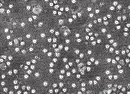 szétterülés folyamatához (A) A neutrofilek zselatináz-ürítése immunkomplex felszínen (reprezentatív zimogram, n=3) (B)