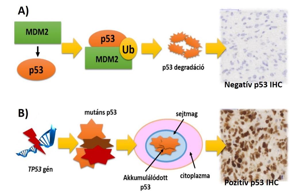4. ábra: A mutáns p53 fehérje immunhisztokémiai detektálásának alapja.