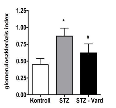 Normális glomeruláris struktúra látható a kontroll vesében (A), enyhe mezangiális expanzió és Bowman-tokhoz kitapadás az STZ