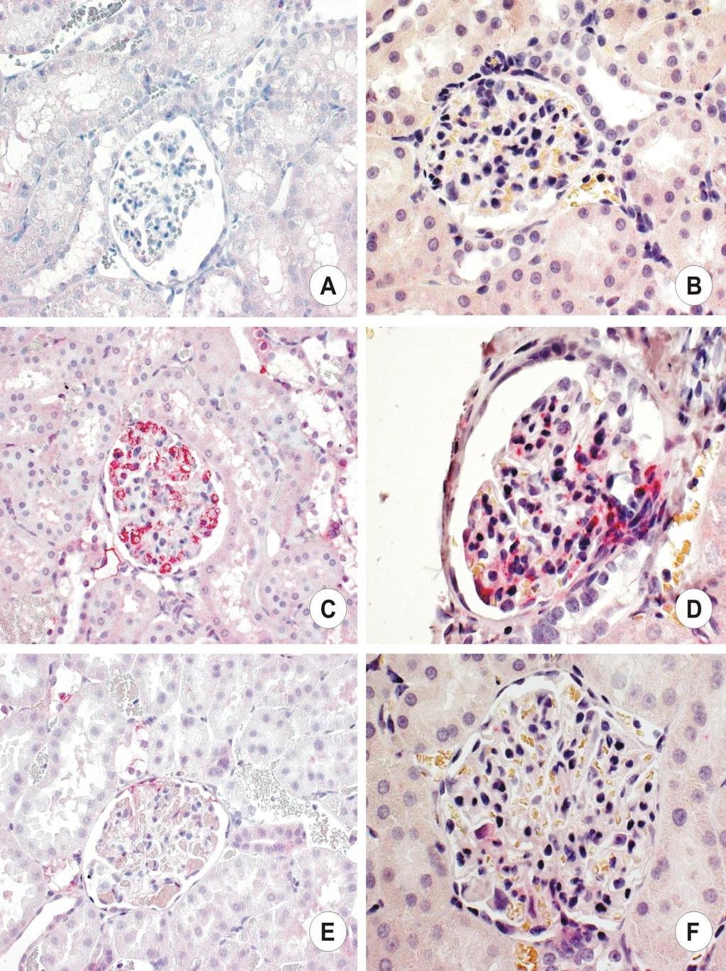 15. ábra: TGF-β1 és dezmin immunhisztokémia reprezentatív képei.