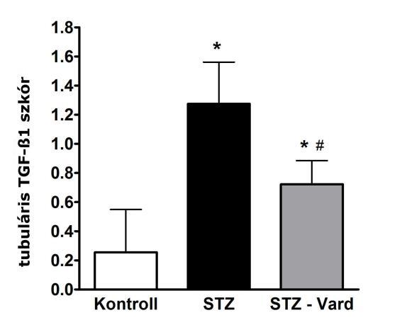 Podocita dezmin pontszám Nefrin pontszám Glomeruláris TGF-β1 pontszám Tubuláris TGF-β1 pontszám DOI:10.14753/SE.2015.1803 A B C D 16. ábra.