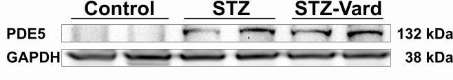 4.1.4 Vardenafil kezelés hatására helyreállt a podociták cgmp tartalma és csökkent a podocita károsodás mértéke Immunblott segítségével fokozott PDE5 expressziót találtunk mind a kezeletlen, mind a