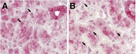 A diabéteszes állatokban glomeruláris és tubulointerstíciális károsodás alakult ki: mezangiális kiszélesedés és tubuláris atrófia, hialin lerakodások és enyhe mononukleáris sejtes beszűrődés, amely a