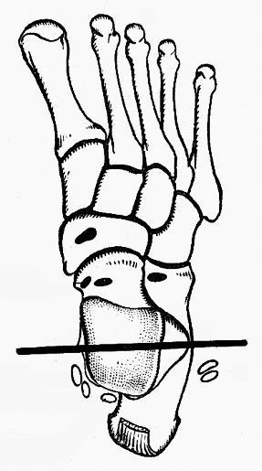 Benninghoff Lábujjak ízületei 1. Articulationes intermetatarseae: az ossa metatarsalia bázisai között amphiarthrosis összeköttetésben van a Lisfranc-ízület üregével 2.