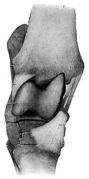 Articulatio talocruralis Felső ugróízület vápa: bokavilla (tibia és fibula; csontos
