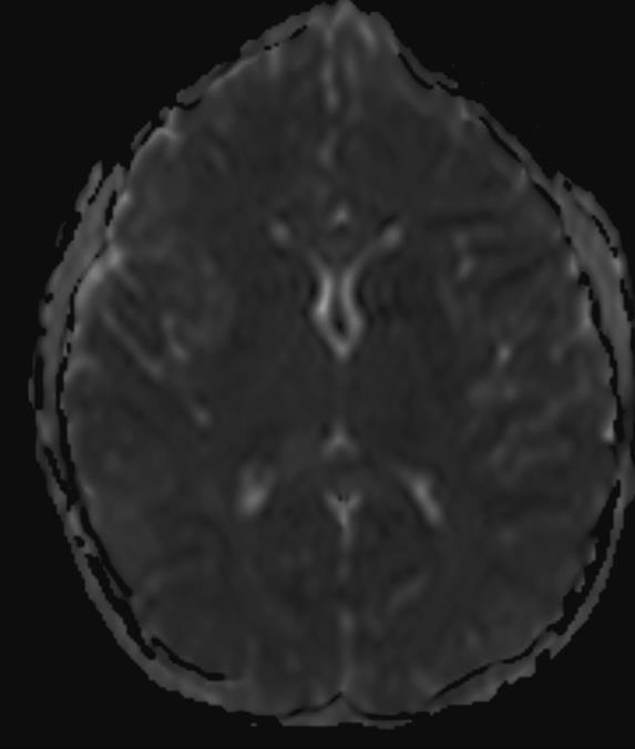 FÁ-ban Thalamus