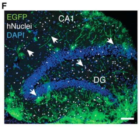 amygdala, thalamus,