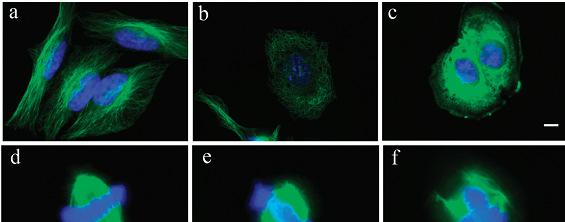 Mikrotubuláris rendszer c (µm) aberráns mitozis (%) vinblasztin dezacetilvinbltrp dezacetilvinbltrparg 8-2 dezacetilvinbltrparg 8-1 interfázis microtubulus Aberráns mitozis (%) interfázis