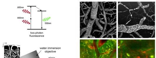 plakkok (kék), Erek (vörös) Neuronok (zöld) Modalitás Előnyei Hátrányai Fontos kontrasztanyag/jel Klinikai alkalmazás példái Molekuláris Képalkotó Kontrasztanyagok Szerkezete CT Any image depths Good