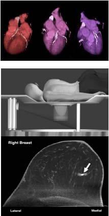 CT Kontrasztanyagok Röntgensugarak 3D elnyelődéstérképe Bármilyen mélységű kép Jó felbontás Egyszerű Közepesen drága Perces képalkotási