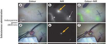 d f Identification of an SLN (arrow in panel e) using 800 nm NIR fluorescence imaging 15 min after injection