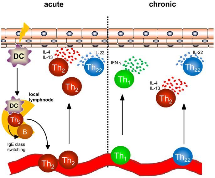 6. ábra: A léziós bőr T sejt összetétele akut és krónikus fázisban (Biedermann, Front. Immunol.