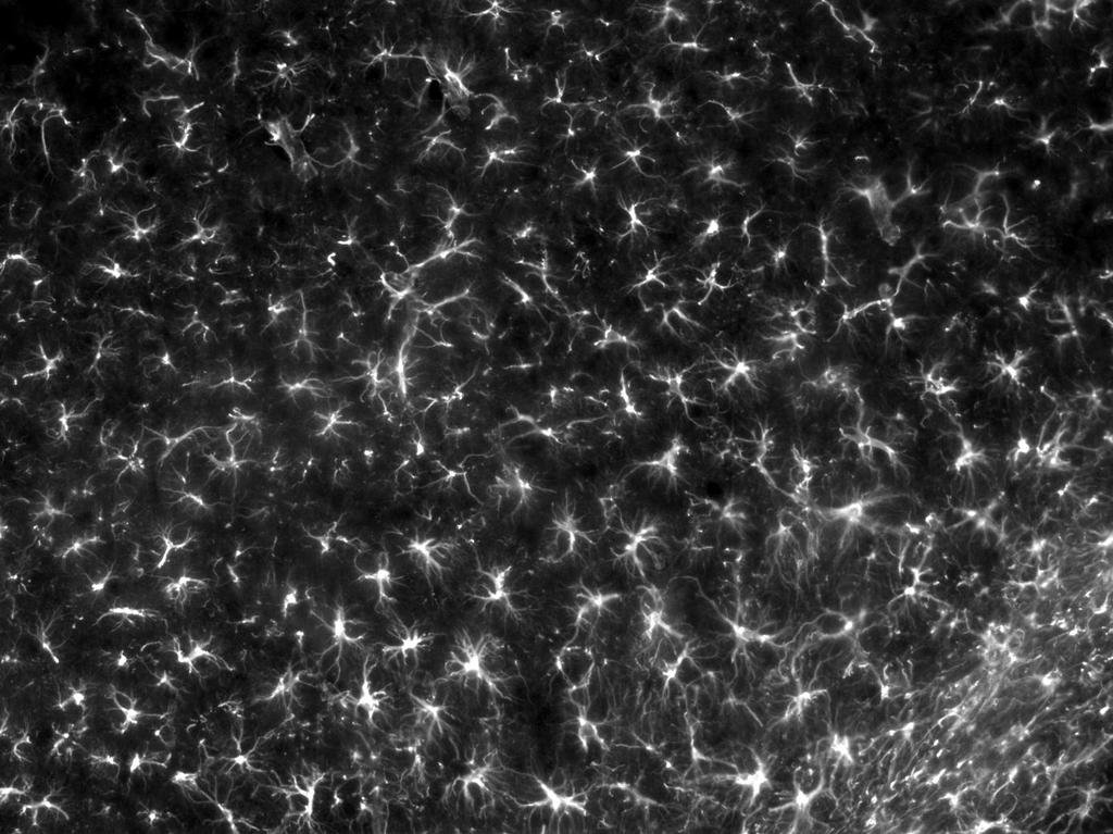 Az asztro- és mikrogliasejtek biológiája