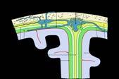 OCULARIS STROKE előjelző szerepe a STROKE megelőzésében *Somlai Judit, **Nieszner Éva,