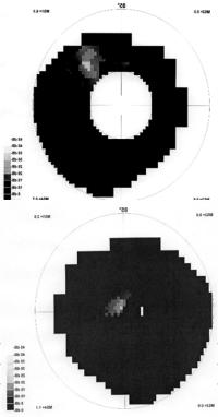 occl:pca, a.bas.