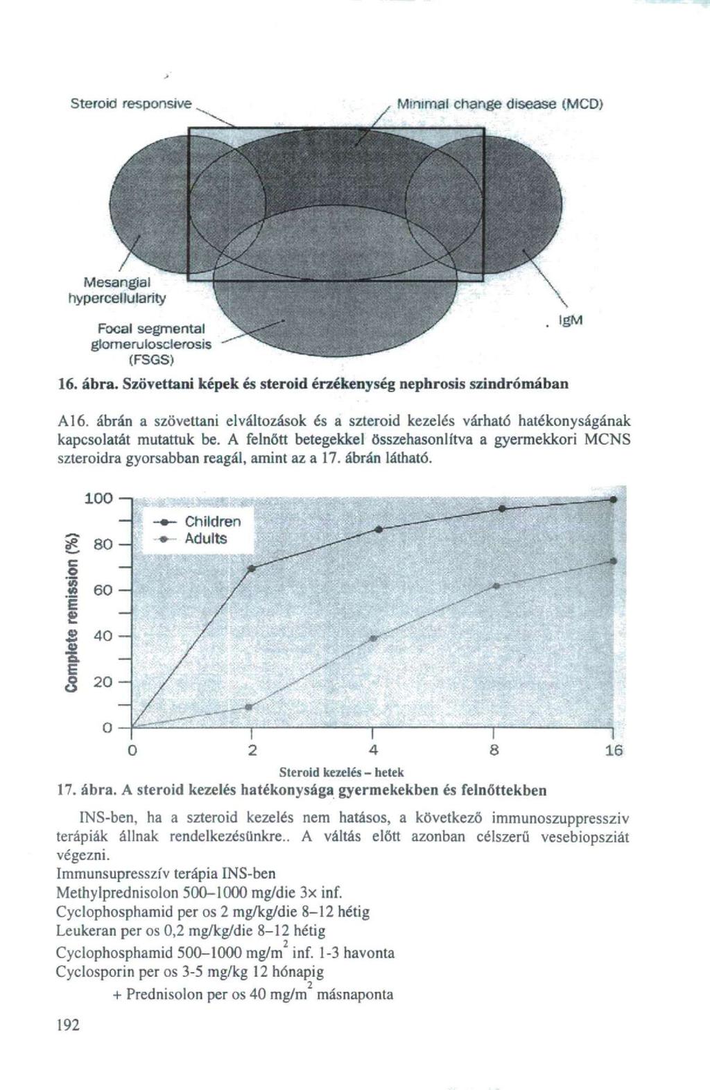 Steroid responsive Minimal change disease (MCD) Mesangial hypercellularity Focal segmentai gíomeruloscíerosis (FSGS) 16. ábra. Szövettani képek és steroid érzékenység nephrosis szindrómában A16.