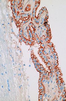 7I8@/3 #$7 FROM CONTENTS AFLATOXINS-INVISIBLE ENEMIES # ' # " # MILDEW INFECTION 2 ELUTION EXPERIMENTS MUNICIPAL SOLID WASTE TRANSCIPTION FACTOR GENE-POWDERY BIOMASS PRODUCTION AND BRIX CONTENT-SWEET