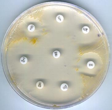 Érzékenységi vizsgálat : elengedhetetlen! Mikrodilúció vagy korongdiffúzió - kb. 95 %-a -lactamase termelő =penicillin G rezisztencia - kb.