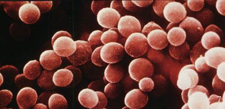 Staphylococcus aureus EM Staphylococcusok gömb alakú, 1 microméter nagyságú baktériumok
