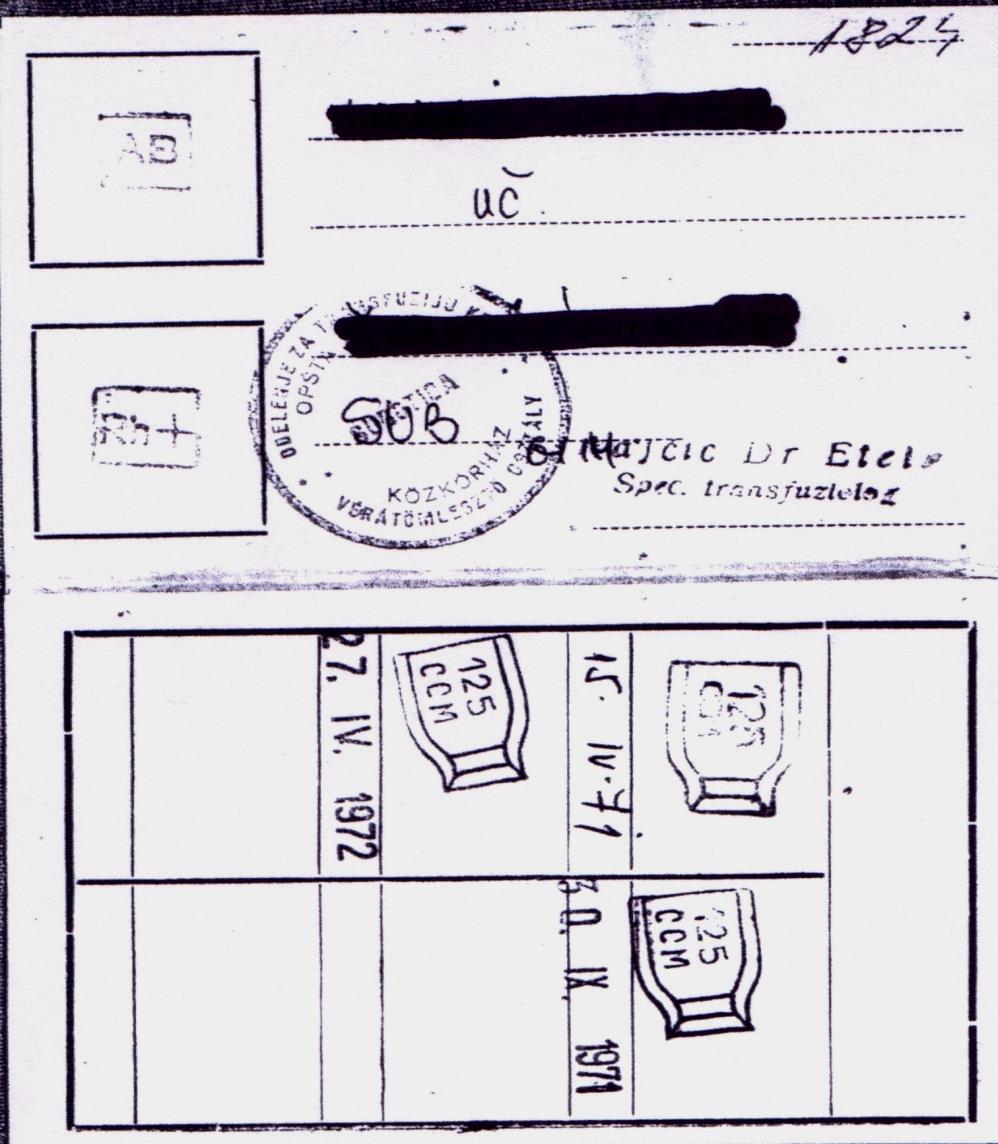 2. Eset (K.K.)* szerzett gyege AB vércsoport tulajdoság 45 éves Dg: ITP traszfúziós aamézis: pozitív ITP-s betegél AML-a alakult ki.