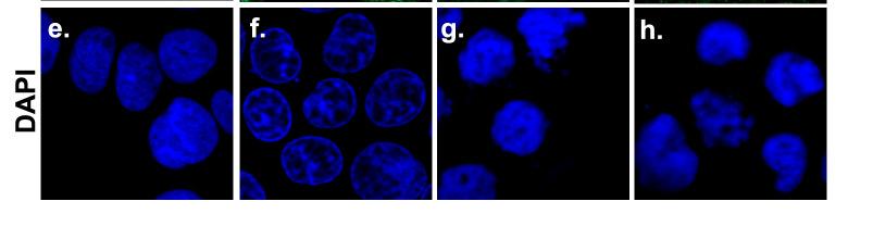 Ezzel szemben CL-A és DNR együttes kezeléseket követıen a MYPT1 és prb eltérı eloszlása figyelhetı meg, mivel a MYPT1 a citoplazmában lokalizálódik (m), míg a prb sejtmagi festıdést mutat (n).