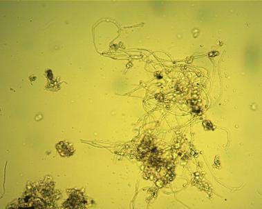 08 MICROTHRIX PARVICELLA Bejelölés néhány 1 igen