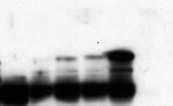 pbin 61S NORK, pbin 61S-NORK-c-myc, pbin 61S NORK-HA vektor konstrukciók, E.coli c. prk helper plazmid, E.coli 2. Agrobacterium konjugátum készítése P14 szupresszor fehérjével a fent leirt módon.