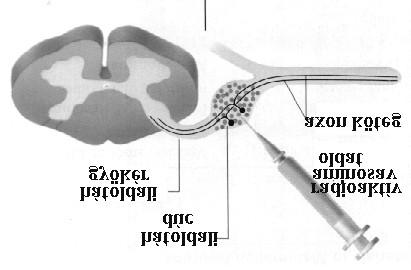 Az axonális