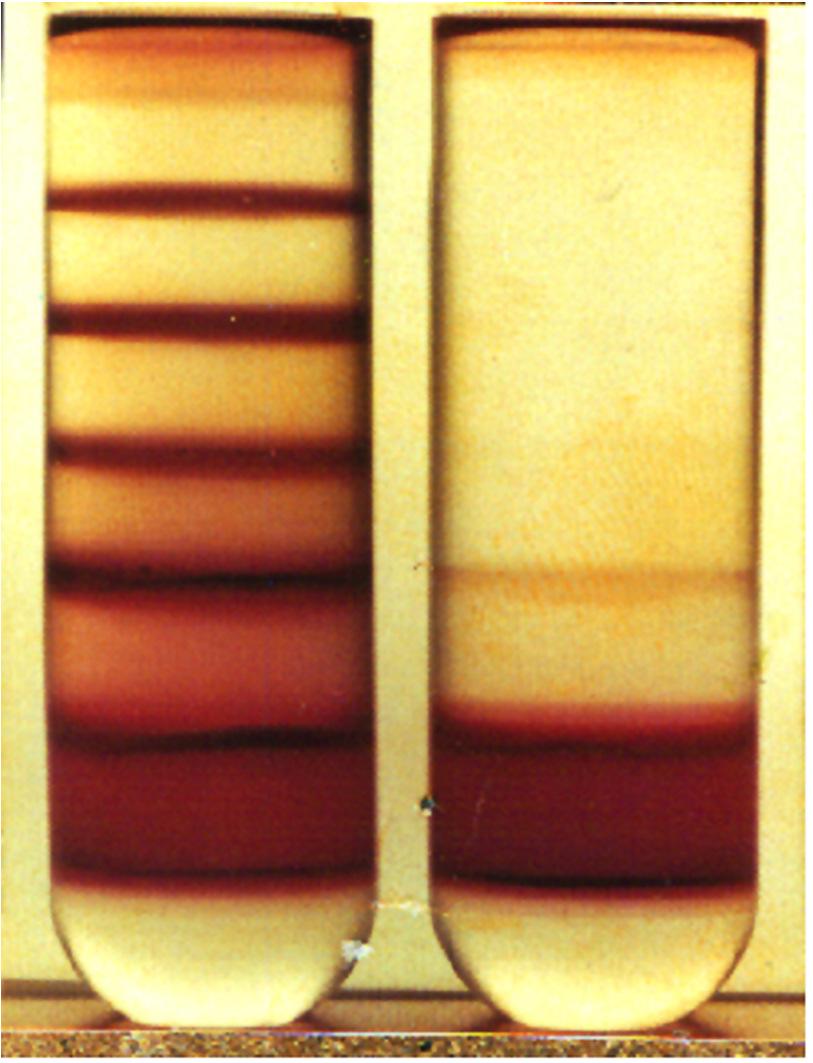 Példa: fertőzött vörösvértestek grádiens centrifugálása A bal oldalon fertőzött sejtek láthatók, amelyeket növekvő koncentrációjú percoll