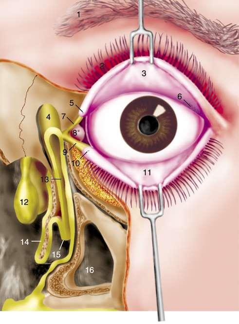 1. szemöldök 2. felső szempillák 5. punctum lacrimale sup. 4. saccus lacrimalis 7. canaliculus lacrimalis sup. 9. canaliculus lacrimalis inf. 13. ductus nasolacrimalis 14.