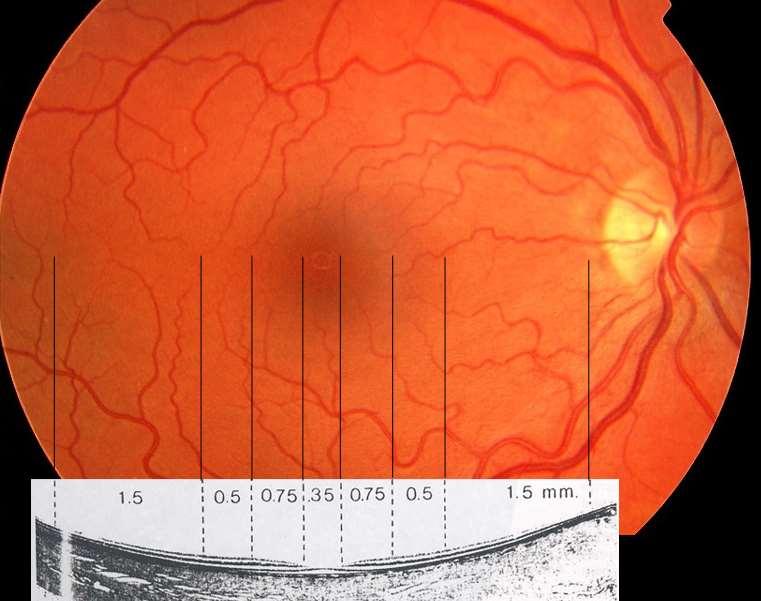 fovea centralis