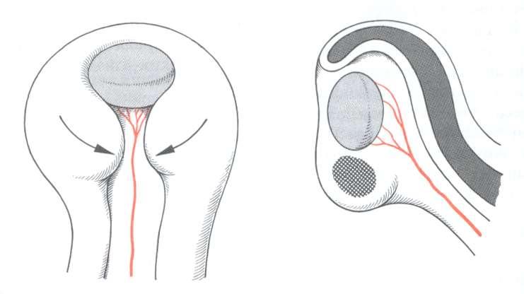 capsula vasculosa lentis A szemserleg kialakulása a szemserleg széle lencsetelep capsula vasculosa lentis