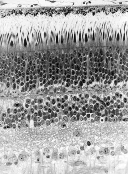 A retina rétegei radialis szövettani metszeten sclera pigmenthám csapok és pálcikák membrana limitans ext. str. granulosum ext.