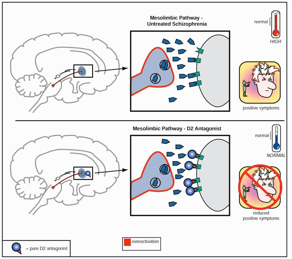 Hiperaktív dopaminerg pálya a limbikus rendszerben D2 dopaminreceptor gátlása antipszichotikummal D2 gátló