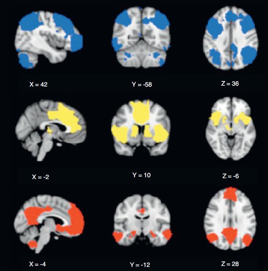 A pszichopatológiai tünetek kialakulásában fontos nagy agyi hálózatok Executiv hálózat Dorsolateralis prefrontalis cortex Posterior