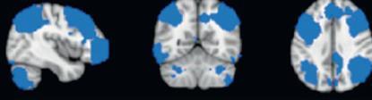 Executiv hálózat Alapja: DLPFC posterior parietalis cortex A központi végrehajtó neuronális korrelátuma: Információ fenntartása és manipulációja a munkamemóriában Szabályalapú problémamegoldás és