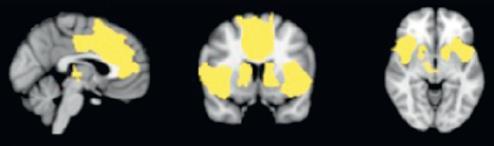 Salience hálózat Alapja: dorsalis anterior cingulum, fronto-insularis cortex + amygdalaventralis striatum-agytörzsi dopamin rendszer Funkciója: jelentőség/újdonság/jutalmazás A homeosztázis