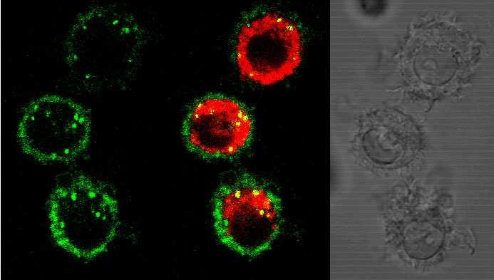 Tanulmányoztuk a natív C3 MDC-khez kötődését konfokális mikroszkópiával is. Jelöltük a C3-al kezelt, majd feltárt mintákon a C3-at (zöld) és a lizoszómák LAMP-1 fehérjéjét (vörös). Az 1.