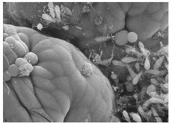 Biofilm: A biofilm egy mikroorganizmusokból álló réteg, amely a vízvezetékek belső felületén alakul ki.