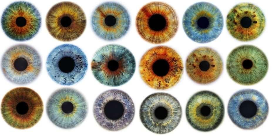 A szem színe A (szem) szivárványhártya színét az iris stromájábsn elhelyezkedő kötőszöveti pigmentsejtek száma, pigmenttartalma és