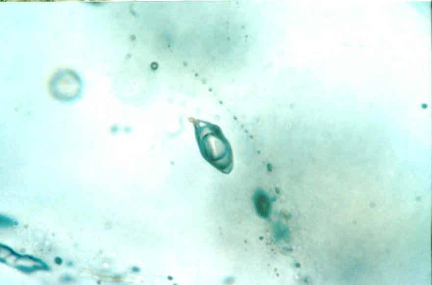 35 3 Variszkuszi posztmagmás fluidcirkuláció: fluidzárvány petrográfia, mikrotermometria és termobarometria L+V, Th (L-V) L Sóoldatos zárvány Pegmatit Széndioxidos-sóoldatos zárvány