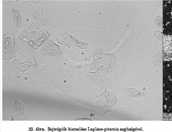 A 23. áb-rán különböző méretű, alakú és textúrajú sejtek láthatók. Egyes sejtek kontrasztja igen alacsony. Az alkalmazásban a cél a sejtrégiók meghatározása volt.