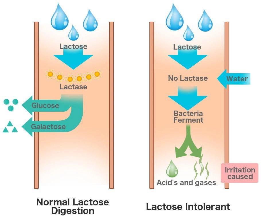 Laktóz