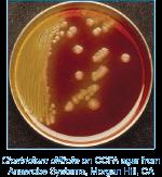 cytotoxin Toxin