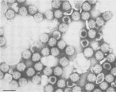 V. Irodalmi áttekintés V.1.