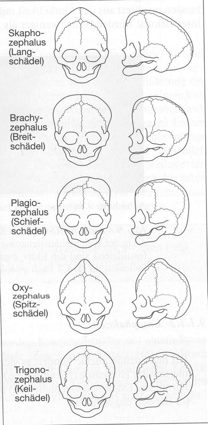 Az agykoponya fejlődése A suturák záródása jelenti a suturális növekedés befejeződését.