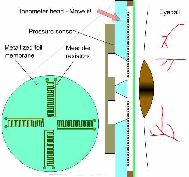 SZEMNYOMÁS MÉRÉSE: TONOMÉTER Szemnyomás (IOP, intraocular pressure) Diagnosztikai szerep: glaukóma Mőködés: A szemgolyót a szaruhártyánál megnyomva egy adott nagyságú felületen síkfelületőre