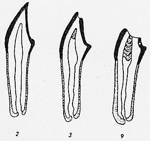 13. ábra: Pótdentin réteg