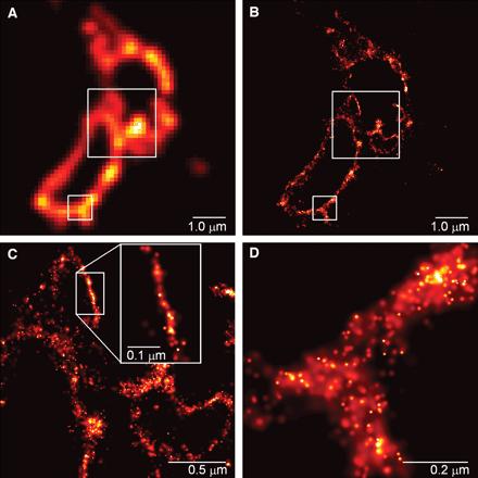 Photo-Activated Localization Microscopy (PALM) CD63, lizoszóma transzmembrán fehérje Atomerő mikroszkóp (Atomic
